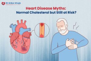 Heart Disease Myths