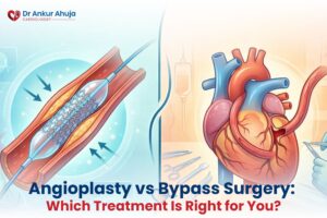 Angioplasty vs Bypass