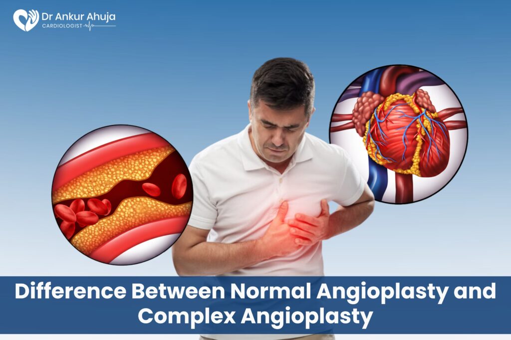 Complex Angioplasty