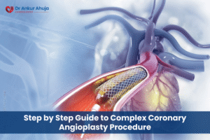 Angioplasty