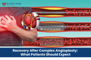 Complex Angioplasty