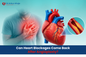 Angioplasty