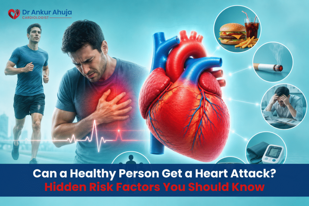 heart attack